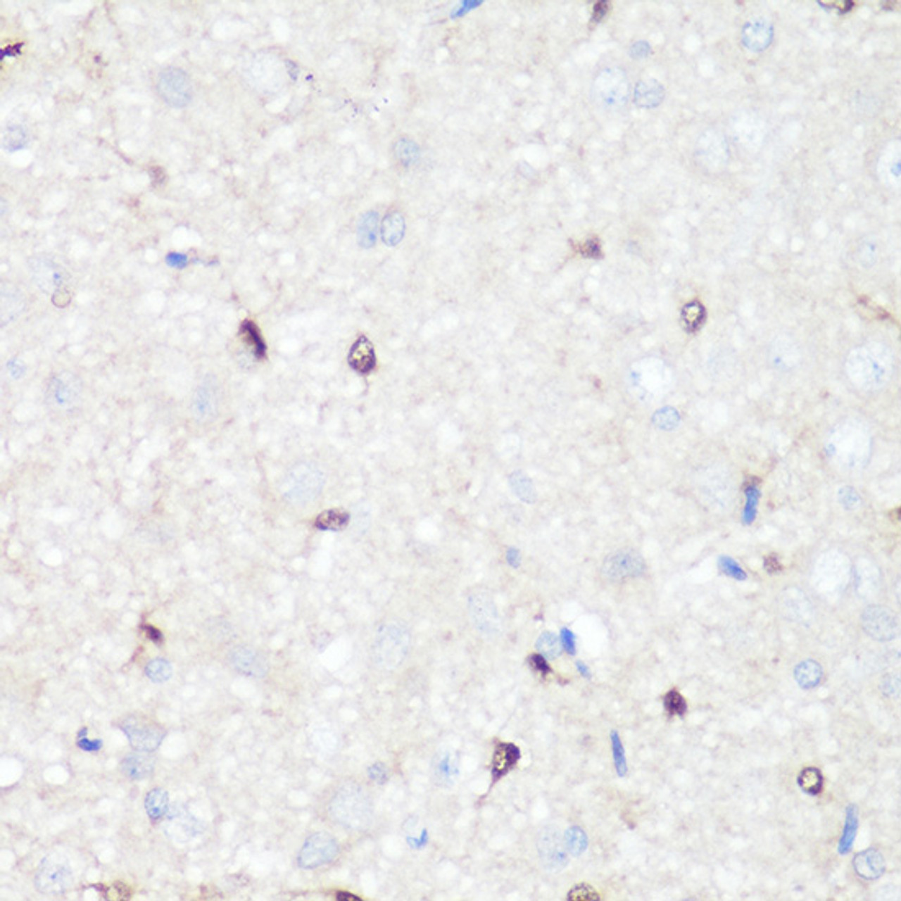 Immunohistochemistry of paraffin-embedded Rat brain using p38 MAPK Polyclonal Antibody at dilution of  1:100 (40x lens).