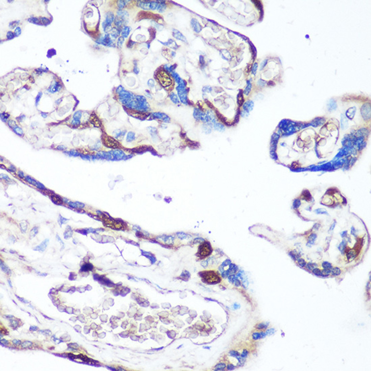 Immunohistochemistry of paraffin-embedded Human placenta using p38 MAPK Polyclonal Antibody at dilution of  1:100 (40x lens).