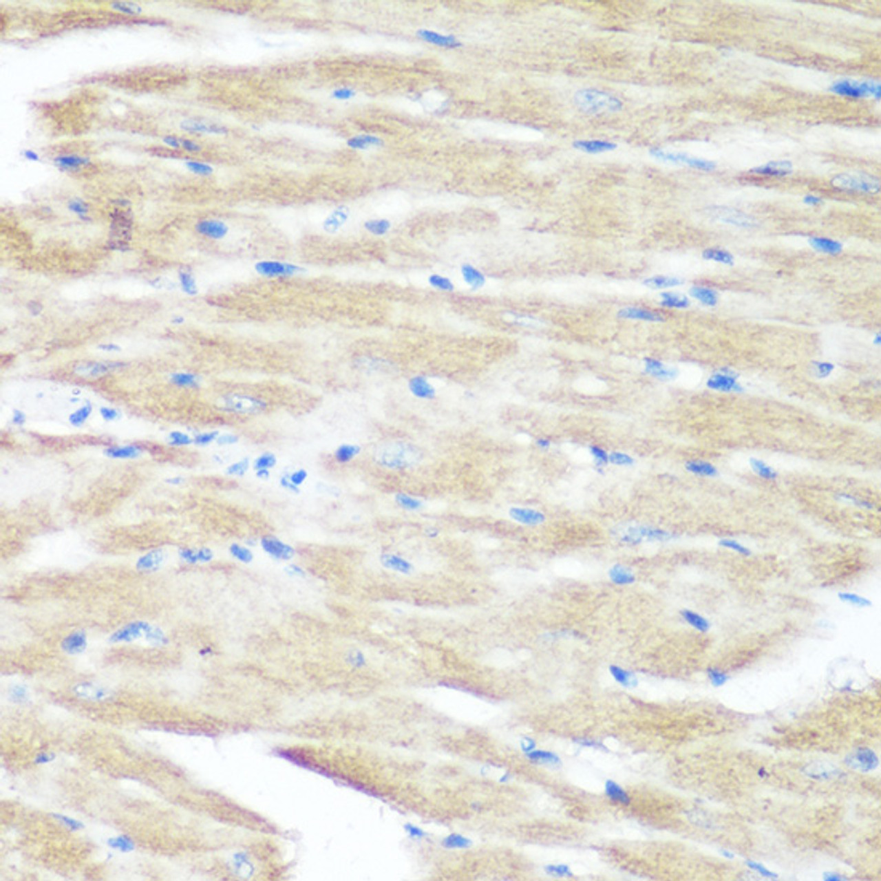 Immunohistochemistry of paraffin-embedded Mouse heart using p38 MAPK Polyclonal Antibody at dilution of  1:100 (40x lens).