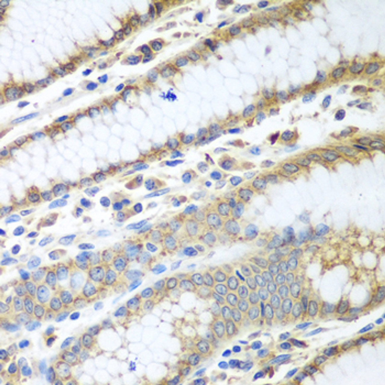 Immunohistochemistry of paraffin-embedded Human stomach using PDIA3 Polyclonal Antibody at dilution of  1:100 (40x lens).