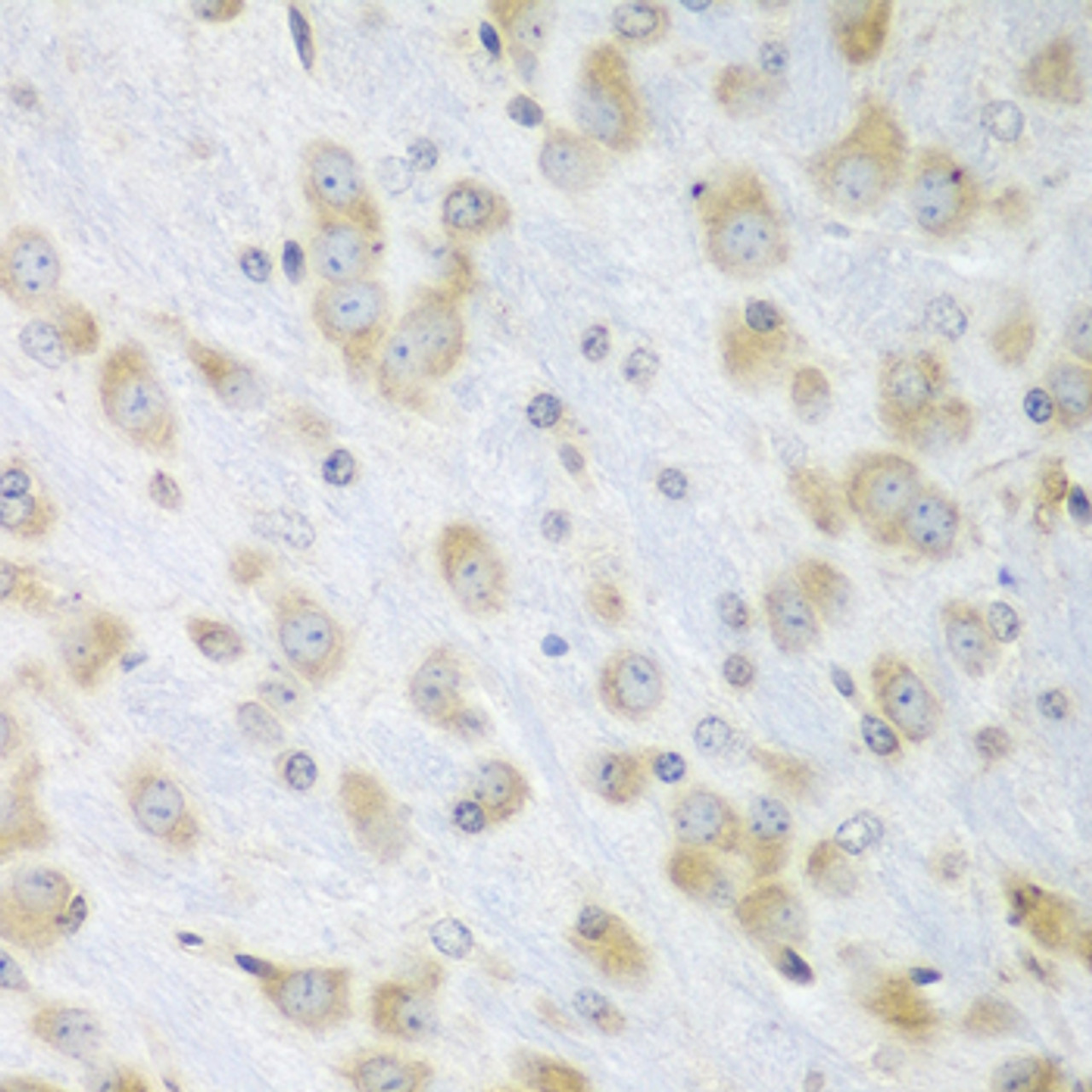 Immunohistochemistry of paraffin-embedded Mouse brain using PDIA3 Polyclonal Antibody at dilution of  1:100 (40x lens).