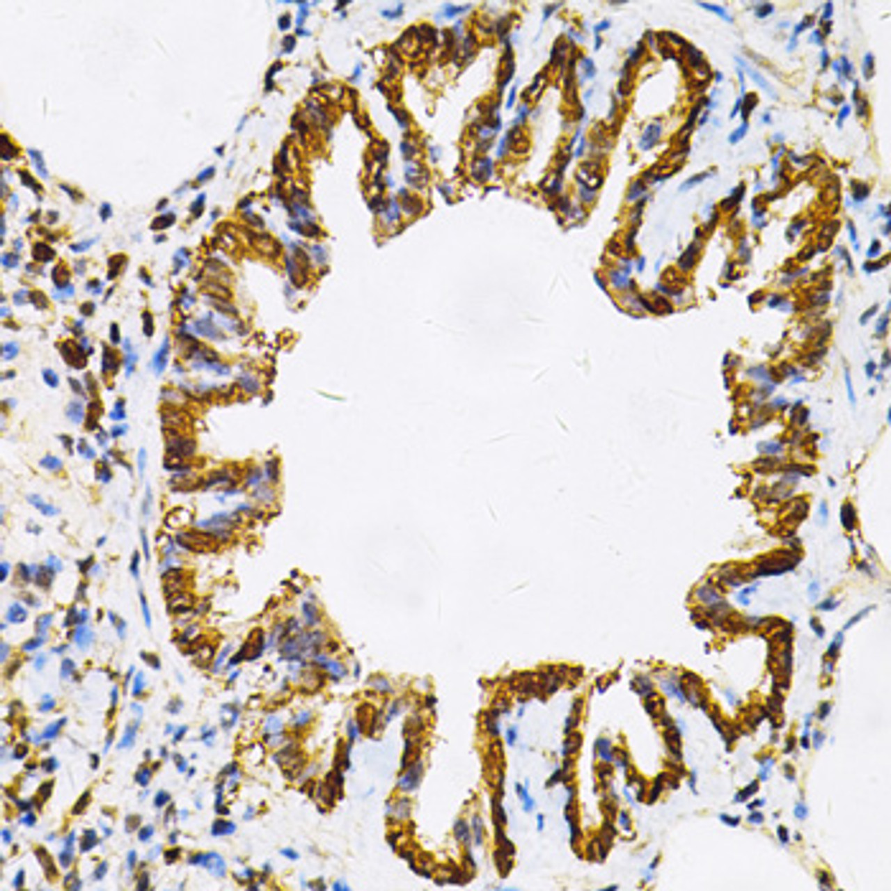 Immunohistochemistry of paraffin-embedded Rat lung using HSP90AB1 Polyclonal Antibody at dilution of  1:100 (40x lens).
