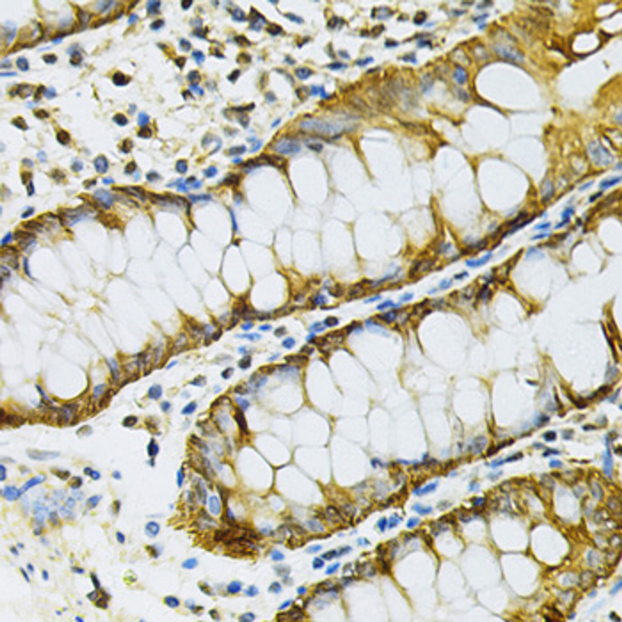 Immunohistochemistry of paraffin-embedded Human colon using HSP90AB1 Polyclonal Antibody at dilution of  1:100 (40x lens).