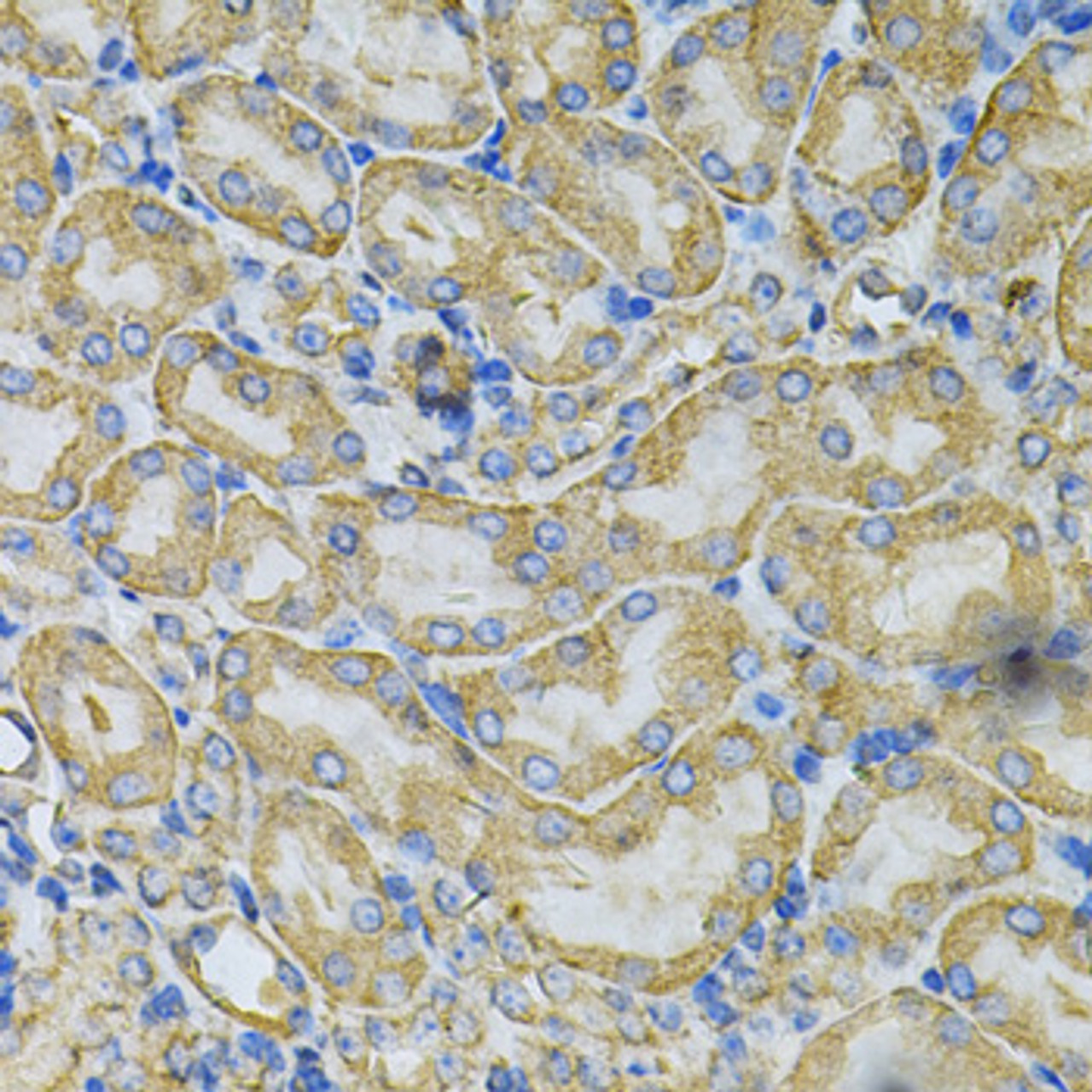 Immunohistochemistry of paraffin-embedded Mouse kidney using HSP90AB1 Polyclonal Antibody at dilution of  1:100 (40x lens).