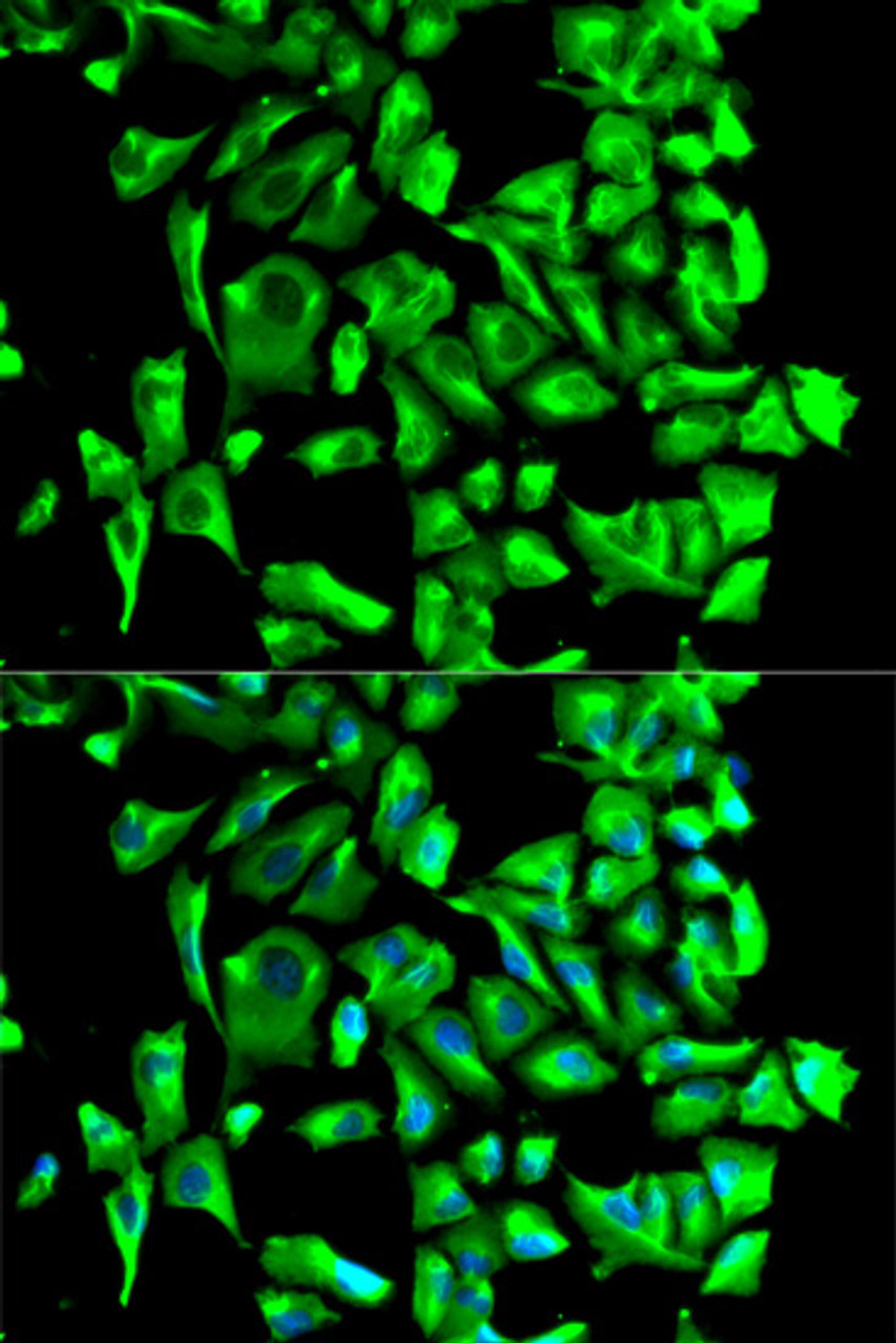 Immunofluorescence analysis of U2OS cells using HSP90AB1 Polyclonal Antibody