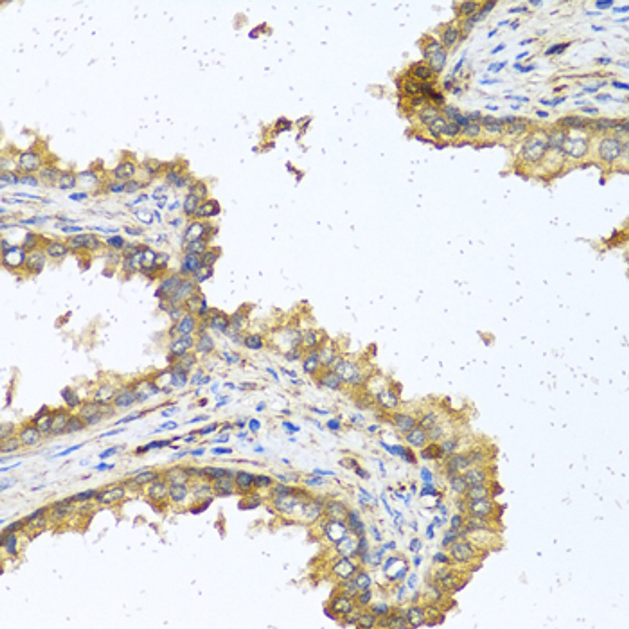 Immunohistochemistry of paraffin-embedded Human prostate using RNASE11 Polyclonal Antibody at dilution of  1:100 (40x lens).