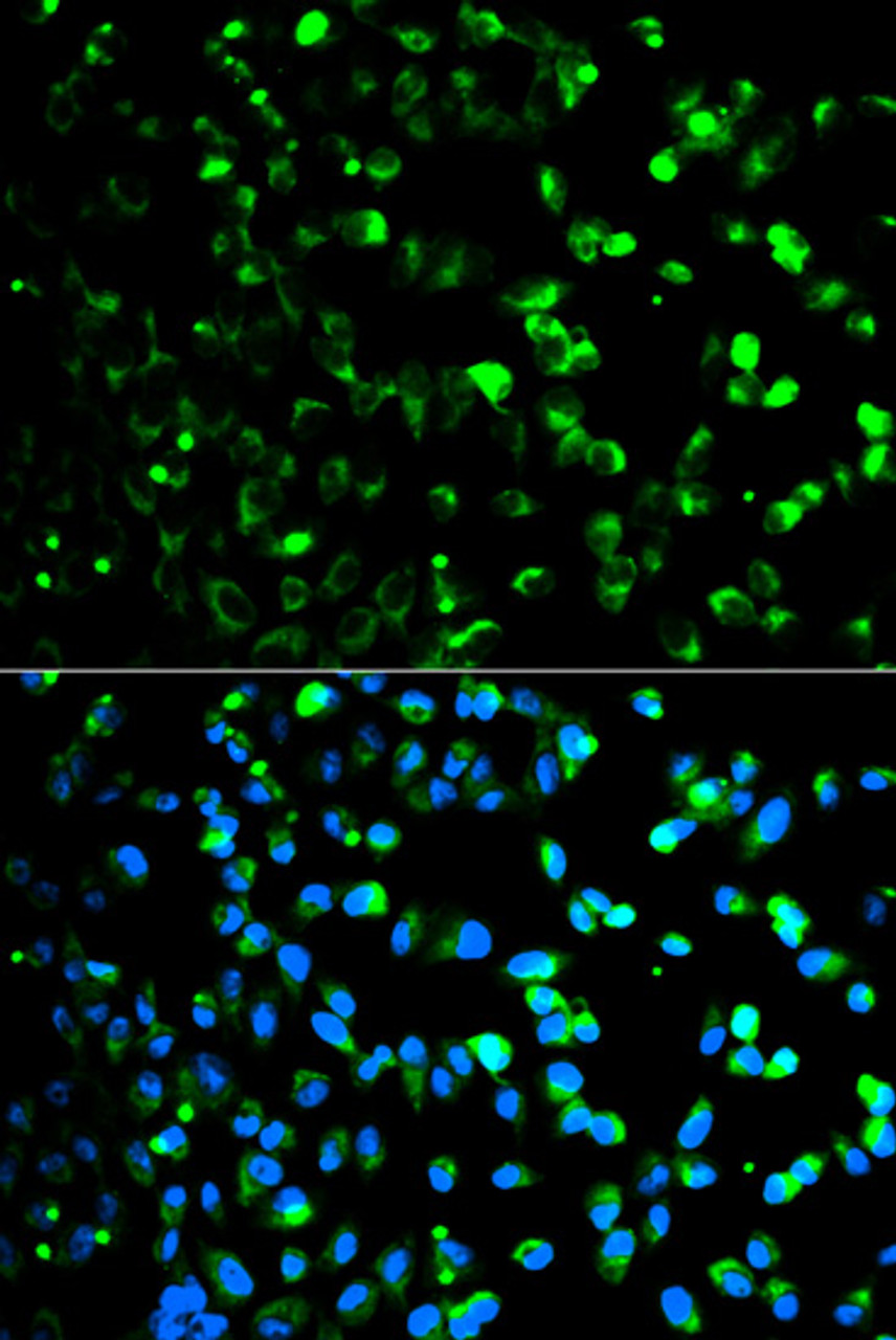 Immunofluorescence analysis of HeLa cells using TYMP Polyclonal Antibody