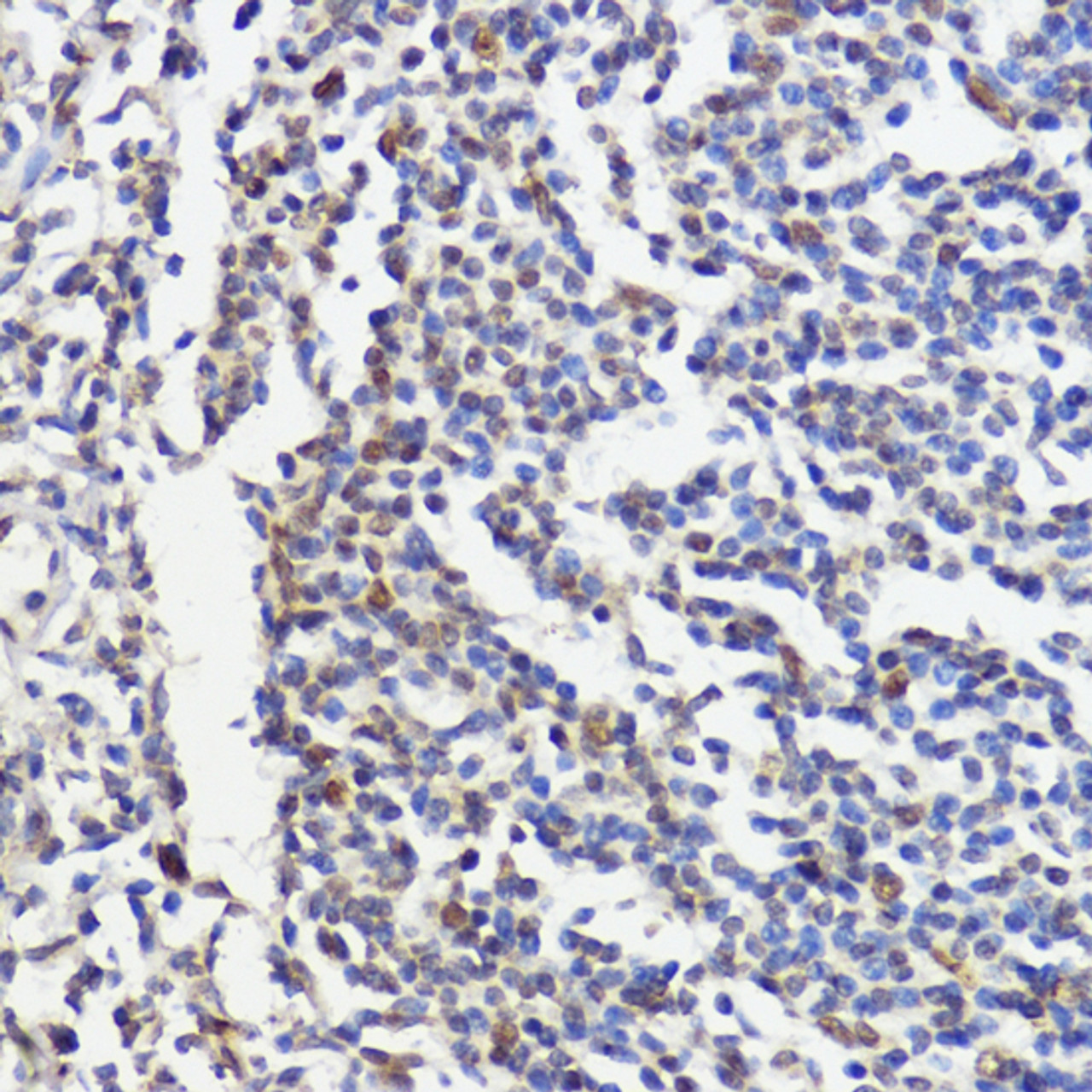 Immunohistochemistry of paraffin-embedded Human tonsil using AKT Polyclonal Antibody at dilution of  1:100 (40x lens).