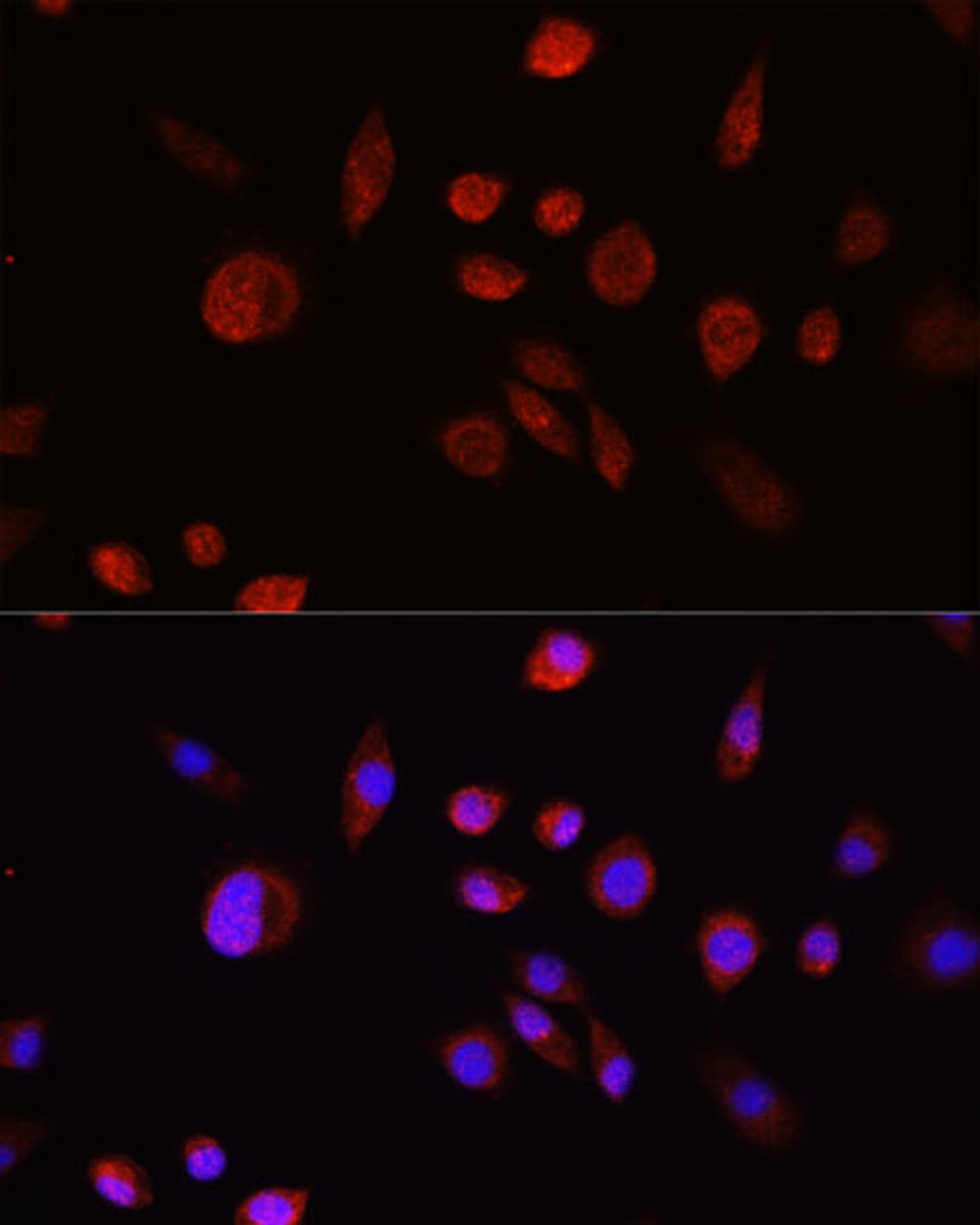 Immunofluorescence analysis of L929 cells using AKT Polyclonal Antibody at dilution of  1:100. Blue: DAPI for nuclear staining.