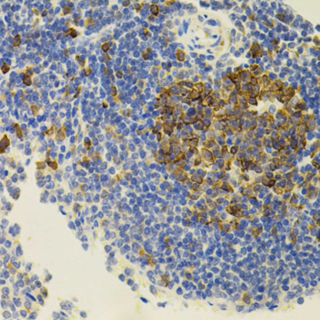 Immunohistochemistry of paraffin-embedded Rat spleen using APP Polyclonal Antibody at dilution of  1:100 (40x lens).