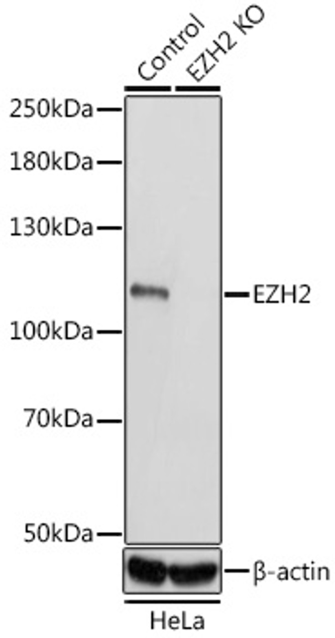 Western blot analysis of extracts from normal (control) and EZH2 knockout (KO) HeLa cells using EZH2 Polyclonal Antibody at dilution of 1:1000.