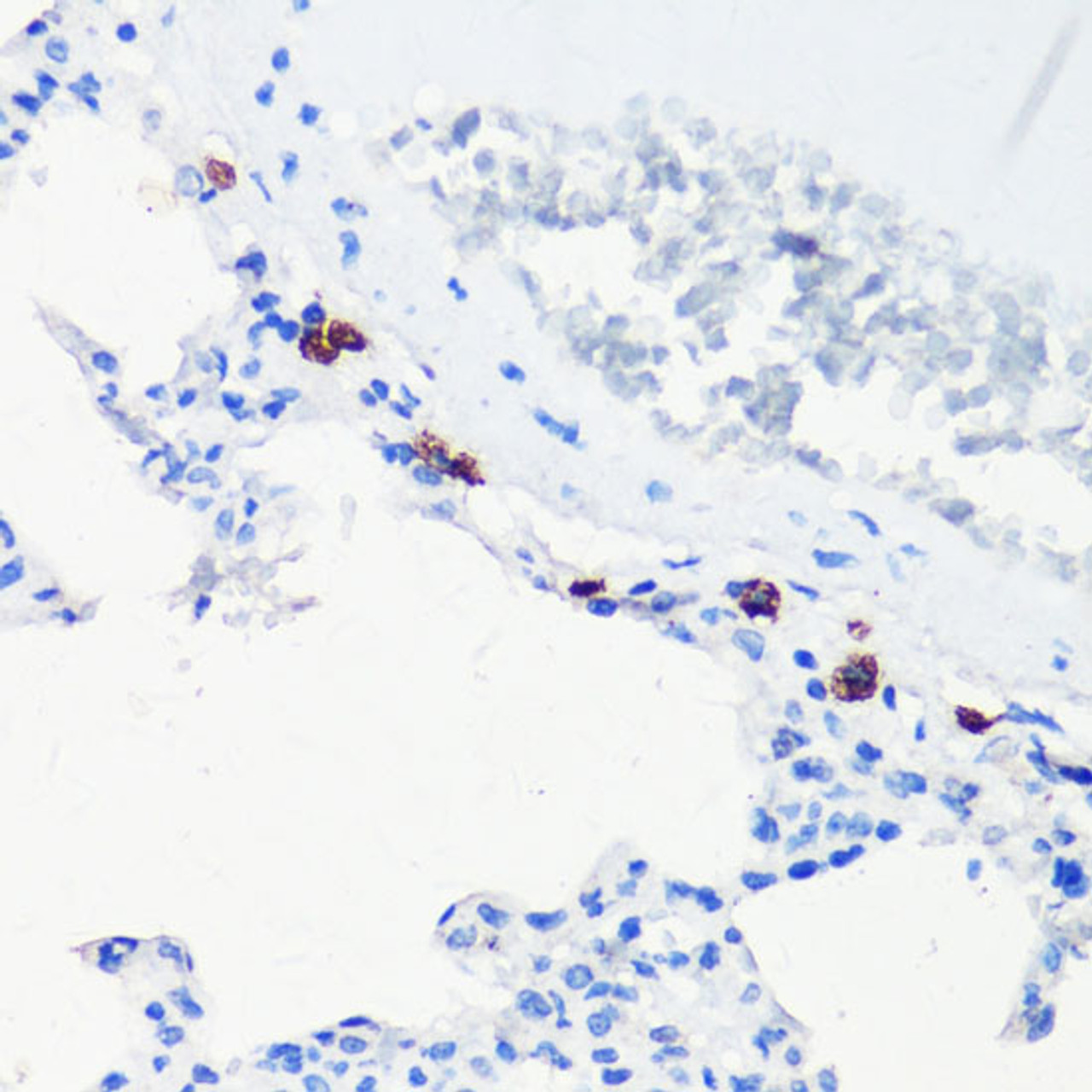 Immunohistochemistry of paraffin-embedded Rat lung using HO-1 Polyclonal Antibody at dilution of  1:200 (40x lens).