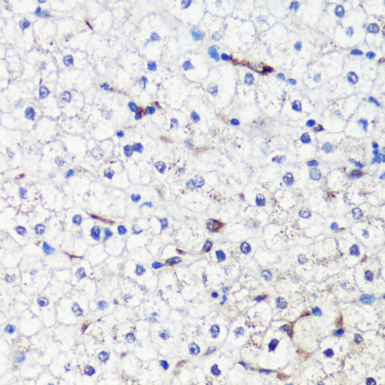 Immunohistochemistry of paraffin-embedded Human liver using HO-1 Polyclonal Antibody at dilution of  1:200 (40x lens).