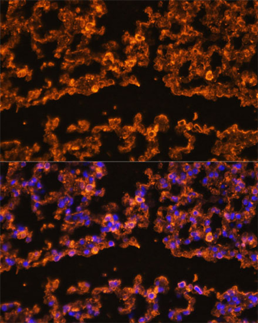 Immunofluorescence analysis of Mouse lung using IL1 beta Polyclonal Antibody at dilution of  1:100 (40x lens). Blue: DAPI for nuclear staining.