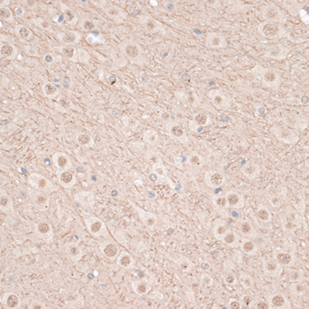 Immunohistochemistry of paraffin-embedded Mouse brain using VEGF Receptor 2 Polyclonal Antibody at dilution of  1:100 (40x lens).
