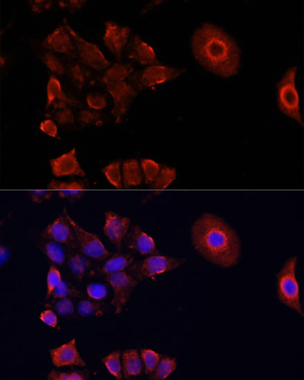 Immunofluorescence analysis of HeLa cells using DAZL Polyclonal Antibody at dilution of  1:100. Blue: DAPI for nuclear staining.