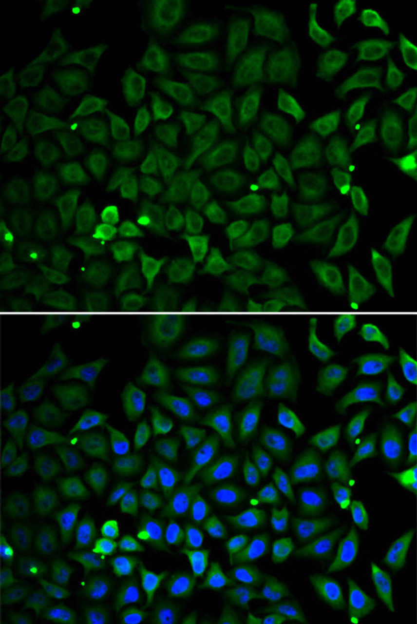 Immunofluorescence analysis of A549 cells using Parkin Polyclonal Antibody