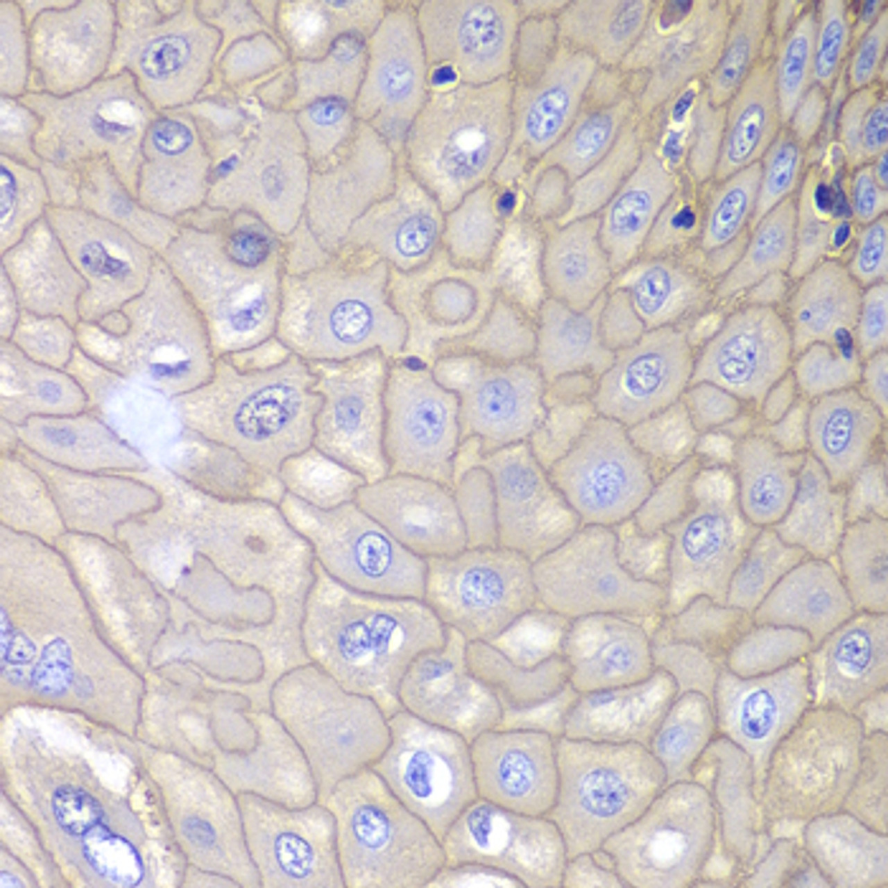 Immunohistochemistry of paraffin-embedded Human esophagus using ANXA1 Polyclonal Antibody at dilution of  1:100 (40x lens).