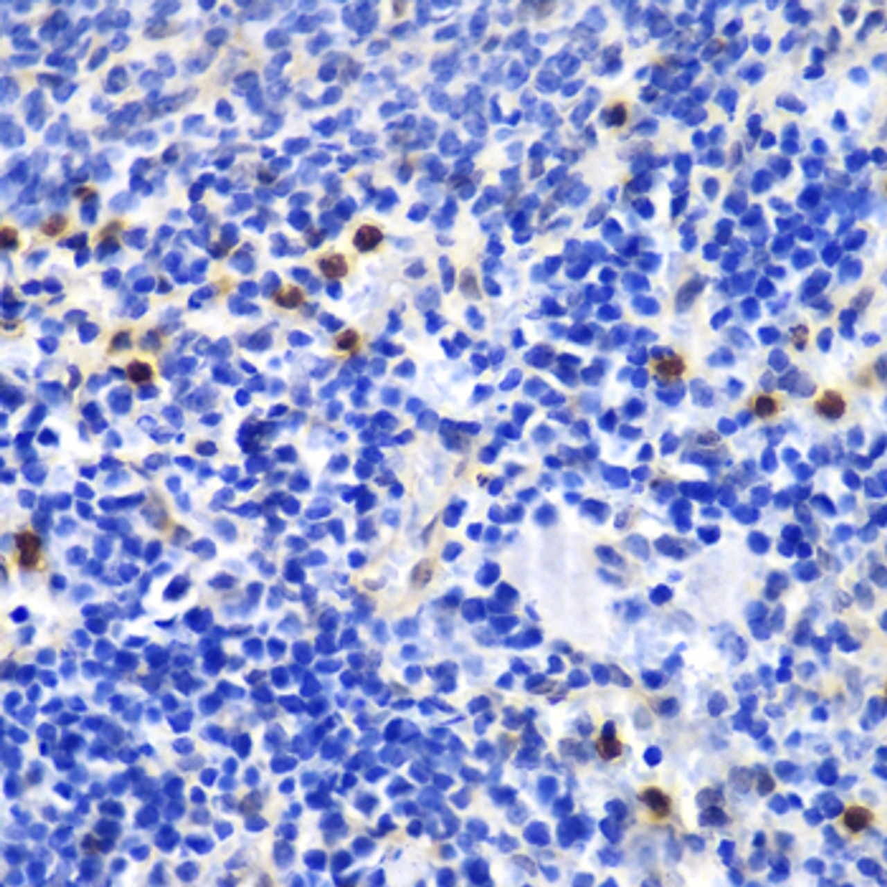 Immunohistochemistry of paraffin-embedded Mouse spleen using ANXA1 Polyclonal Antibody at dilution of  1:100 (40x lens).