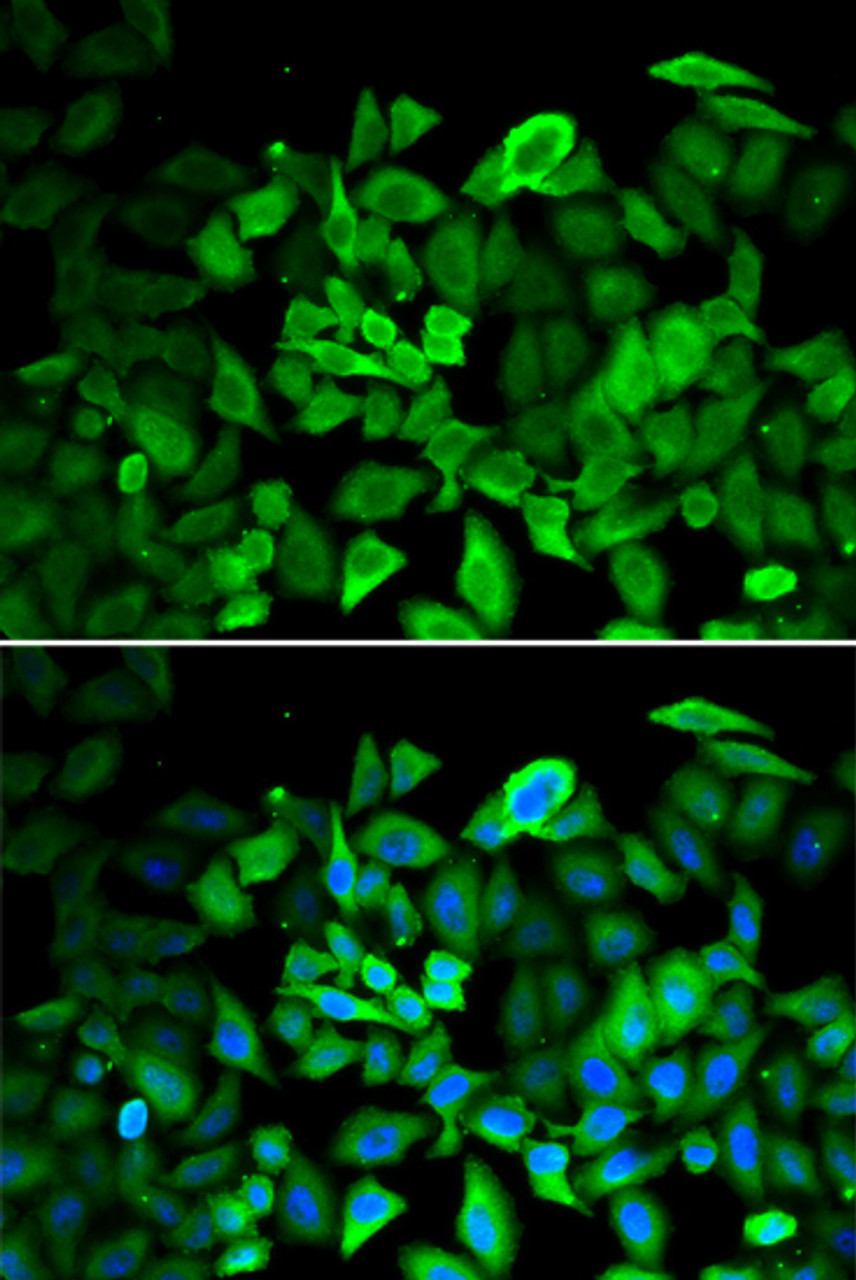 Immunofluorescence analysis of HeLa cells using ANXA1 Polyclonal Antibody
