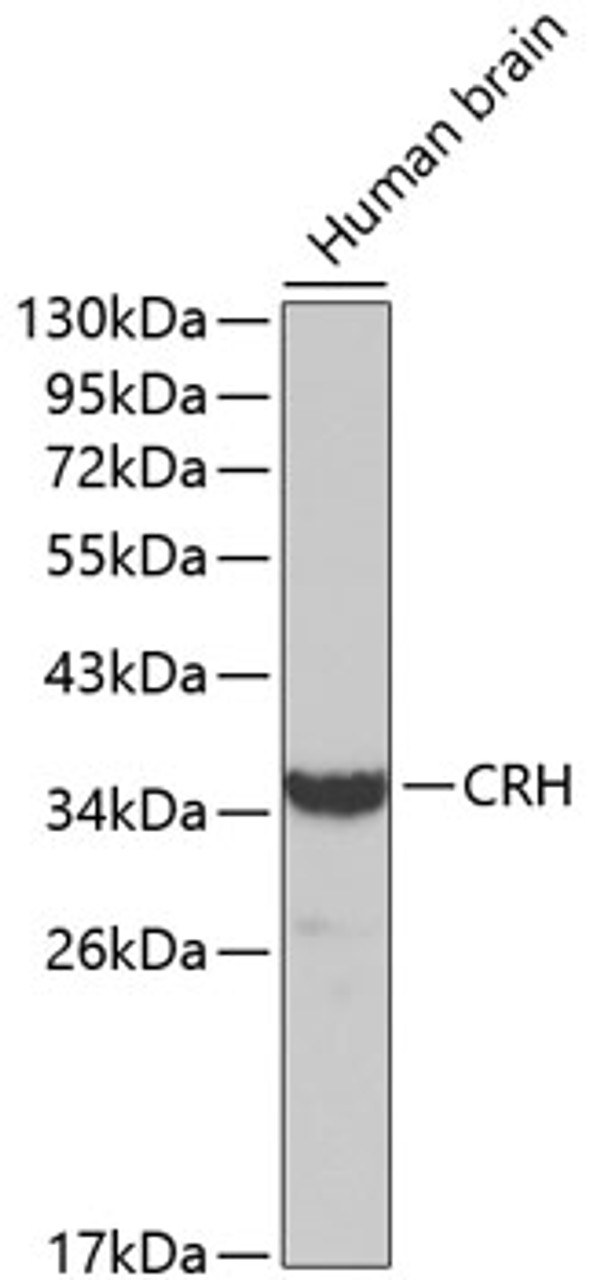 Western blot analysis of extracts of Human brain using CRH Polyclonal Antibody.