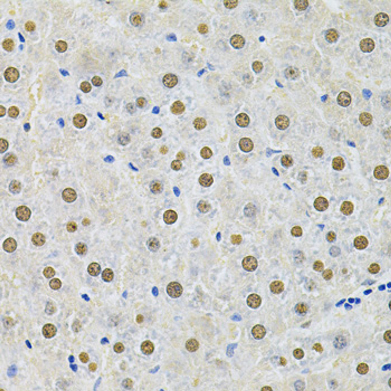 Immunohistochemistry of paraffin-embedded Rat liver using SQSTM1 / p62 Polyclonal Antibody at dilution of  1:200 (40x lens).