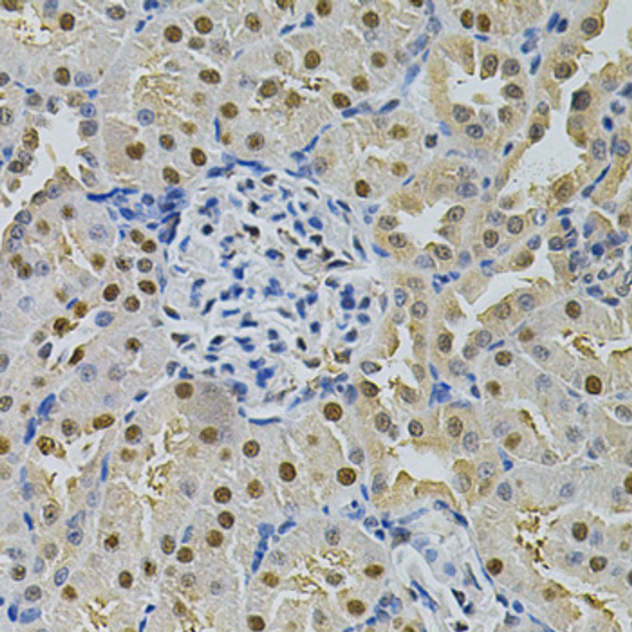 Immunohistochemistry of paraffin-embedded Rat kidney using SQSTM1 / p62 Polyclonal Antibody at dilution of  1:200 (40x lens).