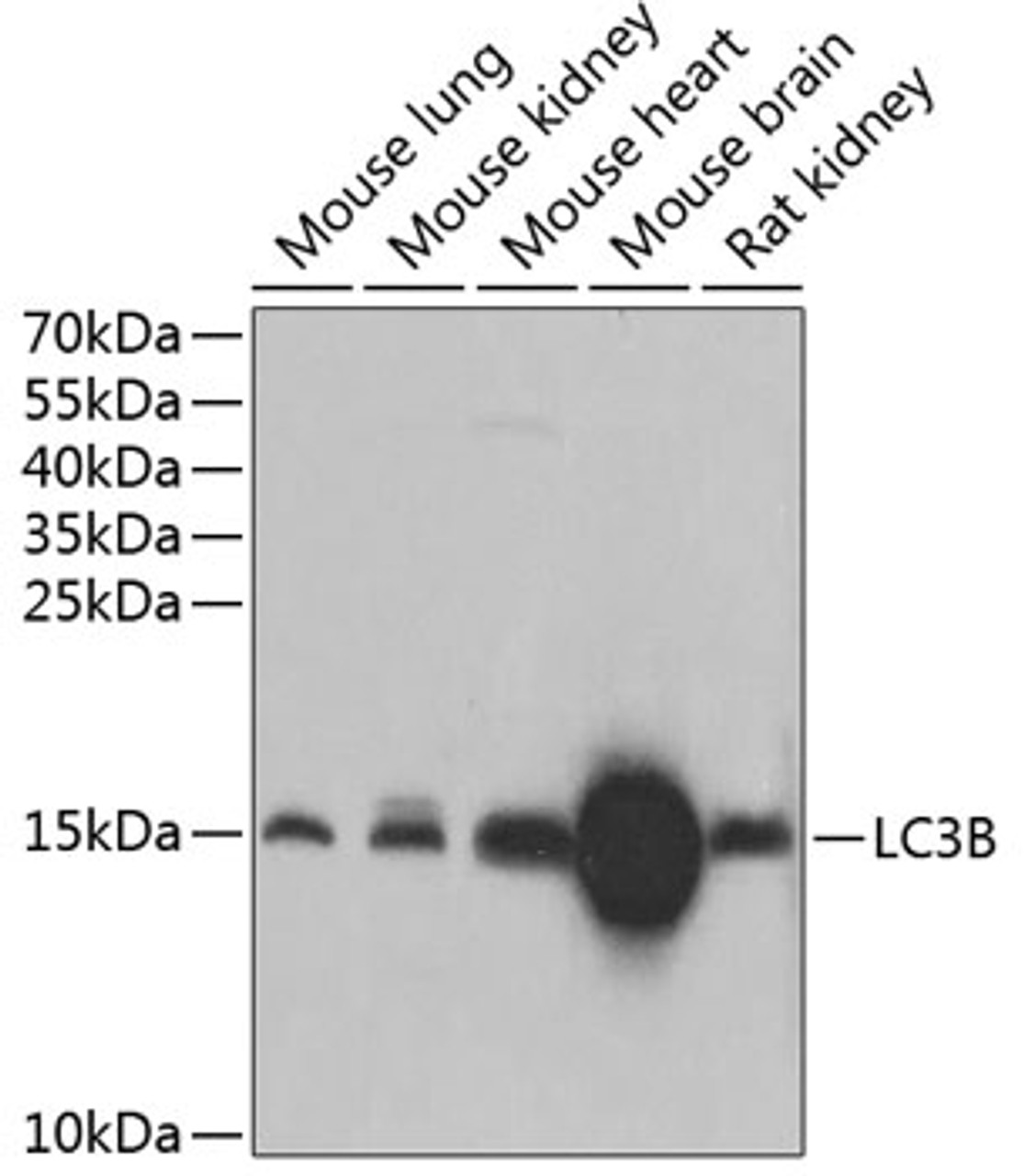 Western blot analysis of extracts of various cell lines using LC3B Polyclonal Antibody at dilution of 1:1000.
