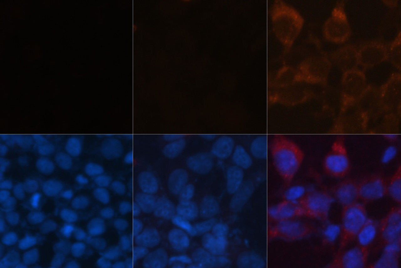 Immunofluorescence analysis of LC3B knockout 293T cells treated by chloroquine (top left) and wild-type 293T cells (top middle)，wild-type 293T cells treated by chloroquine (top right) using LC3B Polyclonal Antibody at dilution of  1:100. Blue: DAPI for nuclear staining.