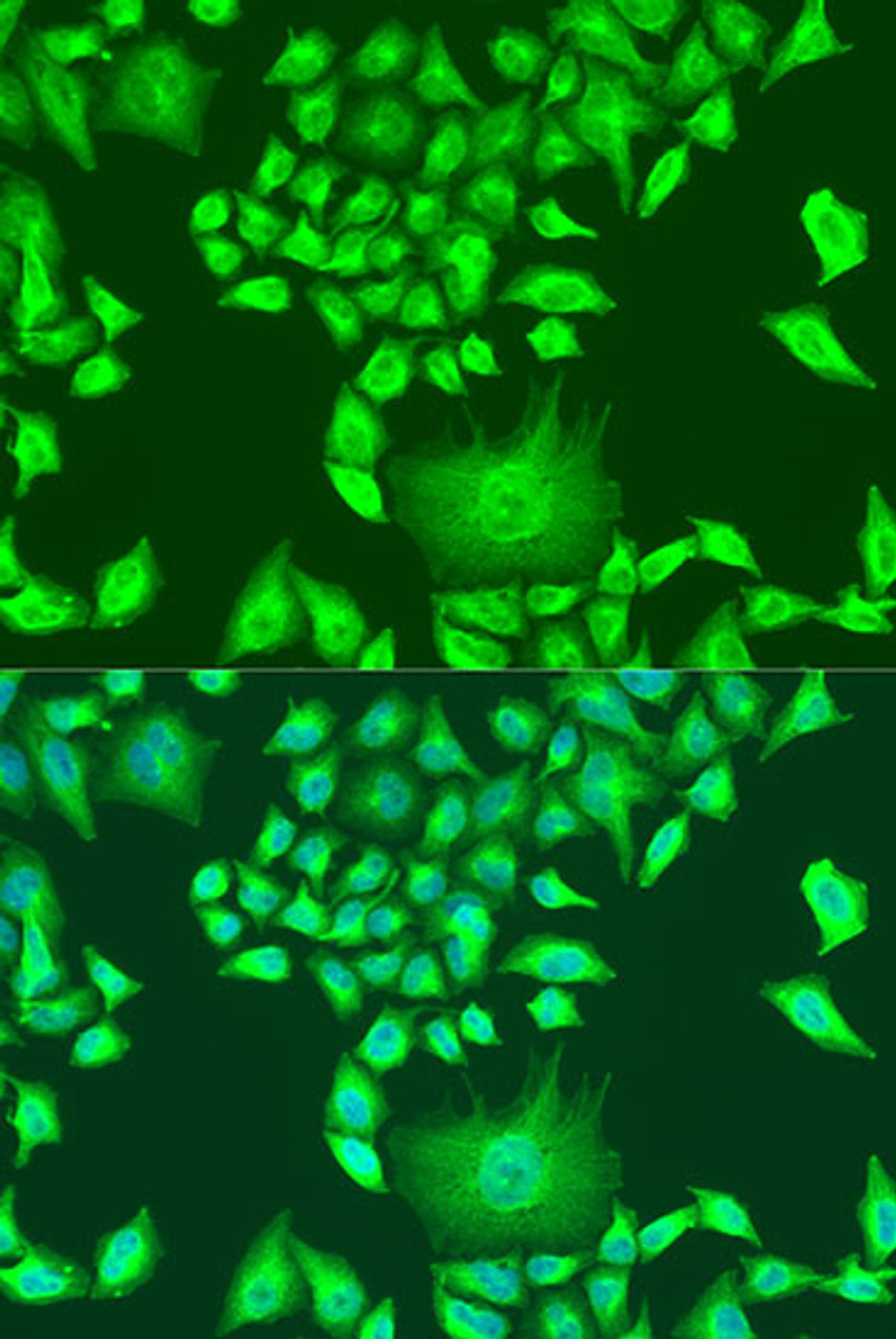 Immunofluorescence analysis of U2OS cells using APOA1 Polyclonal Antibody at dilution of  1:100. Blue: DAPI for nuclear staining.