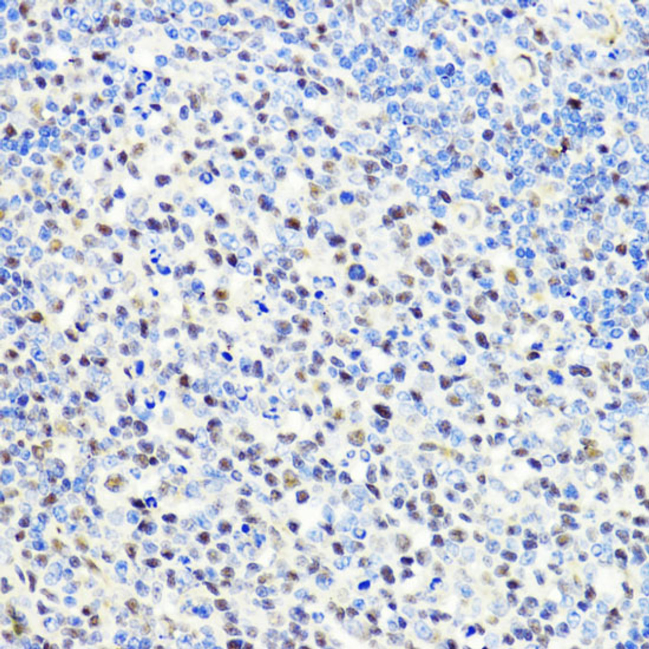 Immunohistochemistry of paraffin-embedded Rat spleen using CTCF Polyclonal Antibody at dilution of  1:100 (40x lens).
