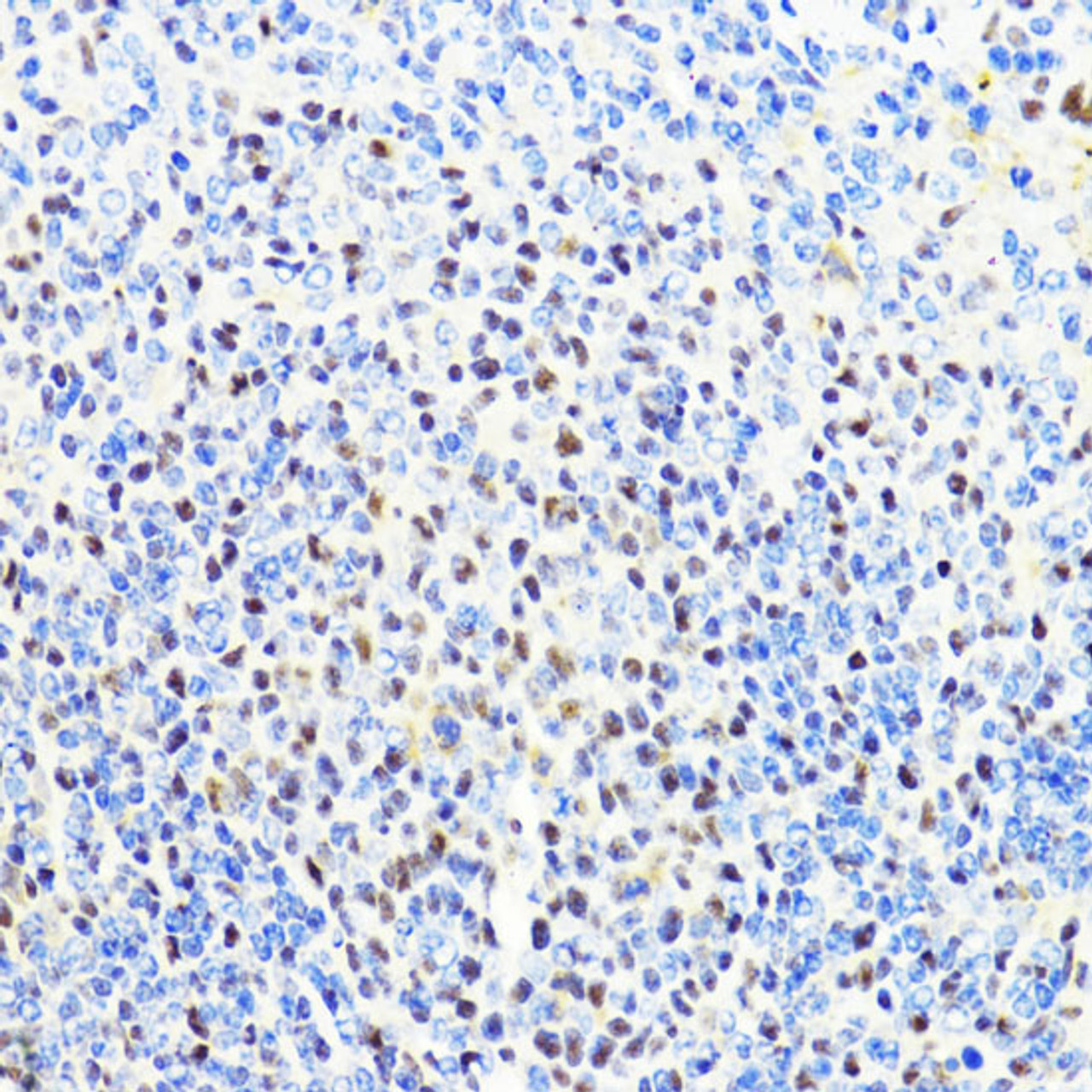 Immunohistochemistry of paraffin-embedded Mouse spleen using CTCF Polyclonal Antibody at dilution of  1:100 (40x lens).