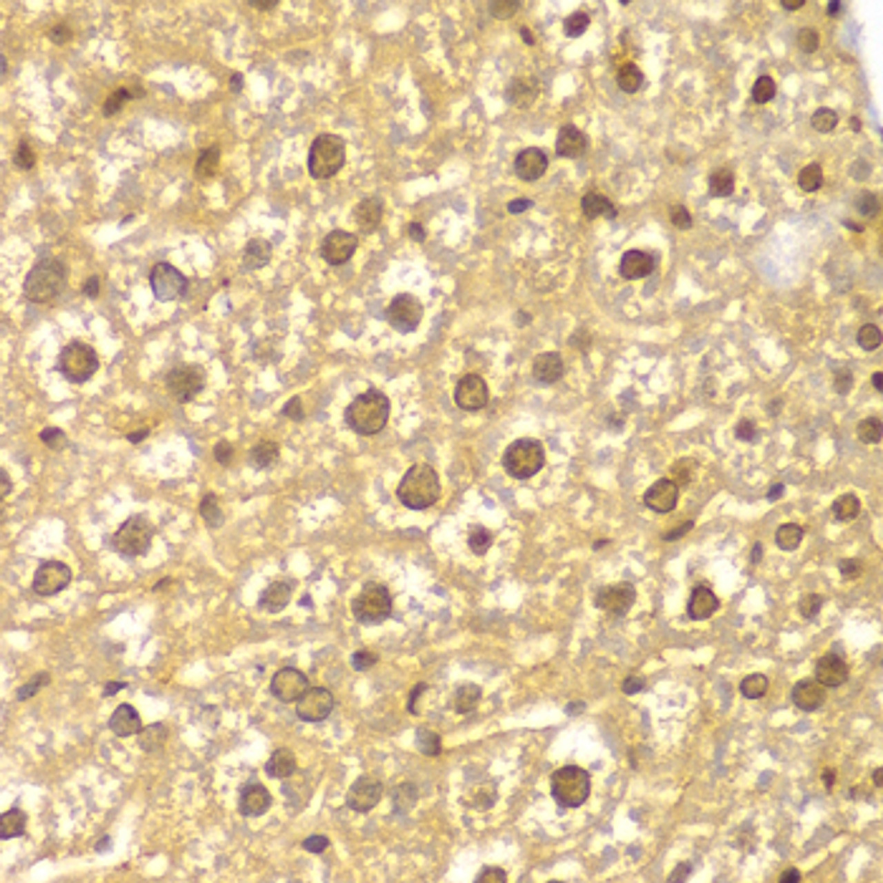 Immunohistochemistry of paraffin-embedded Mouse liver using ASC / TMS1 Polyclonal Antibody at dilution of  1:100 (40x lens).