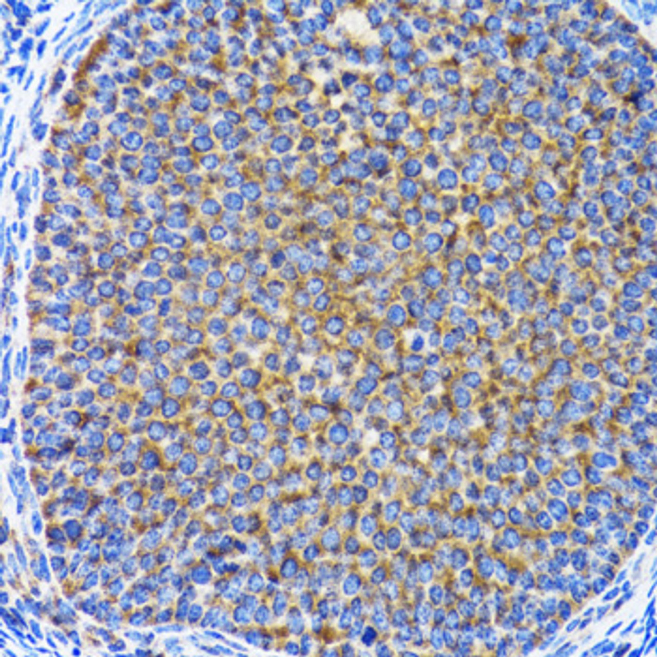 Immunohistochemistry of paraffin-embedded Rat ovary using MAP1LC3A Polyclonal Antibody at dilution of  1:100 (40x lens).