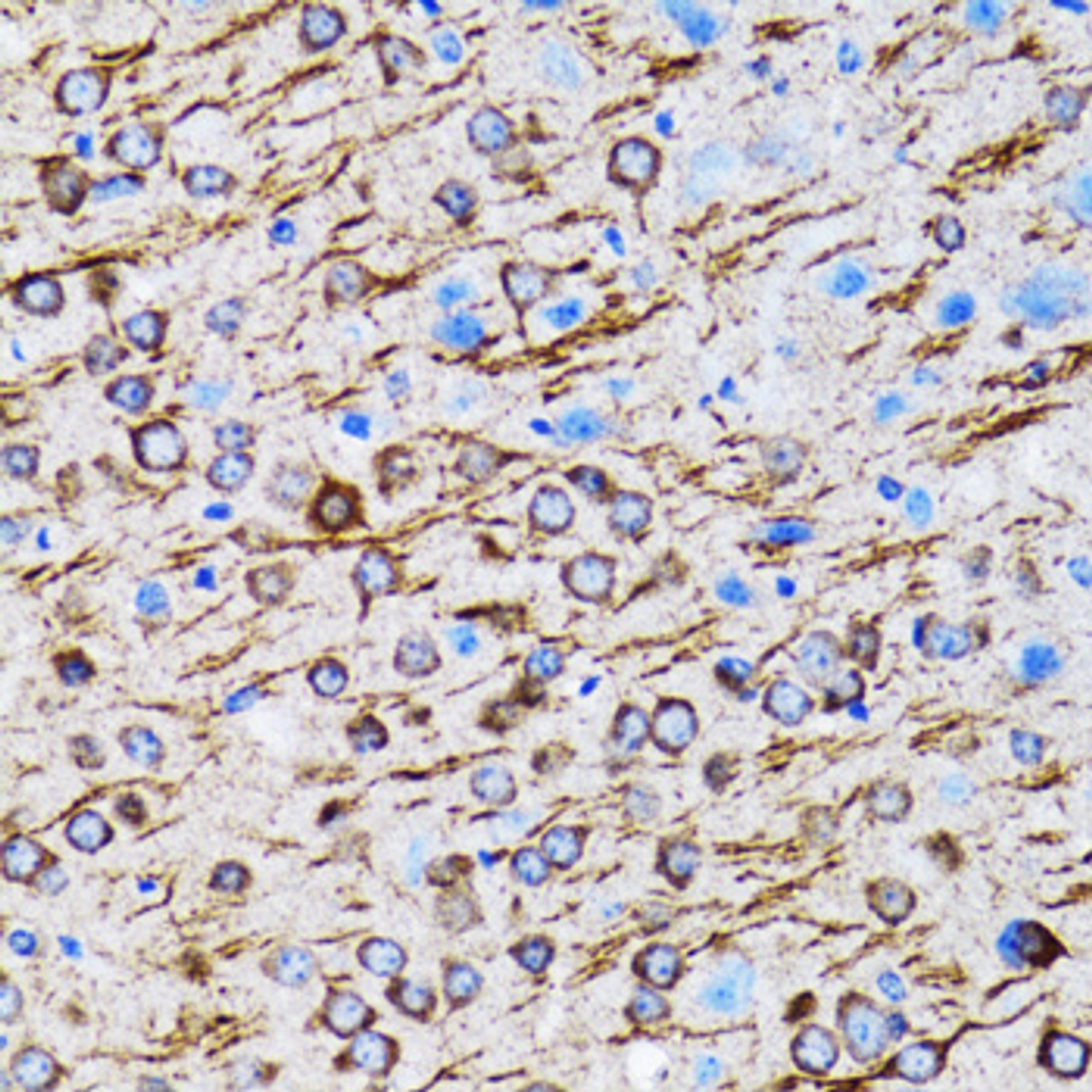 Immunohistochemistry of paraffin-embedded Rat brain using MAP1LC3A Polyclonal Antibody at dilution of  1:100 (40x lens).
