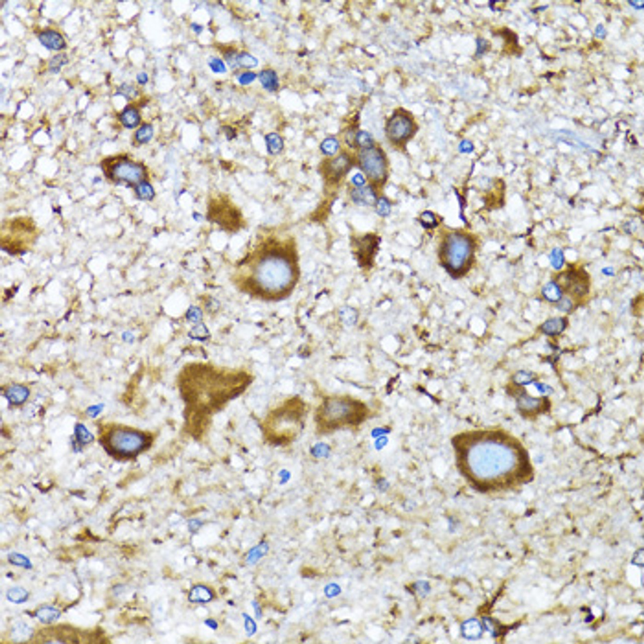Immunohistochemistry of paraffin-embedded Mouse spinal cord using MAP1LC3A Polyclonal Antibody at dilution of  1:100 (40x lens).