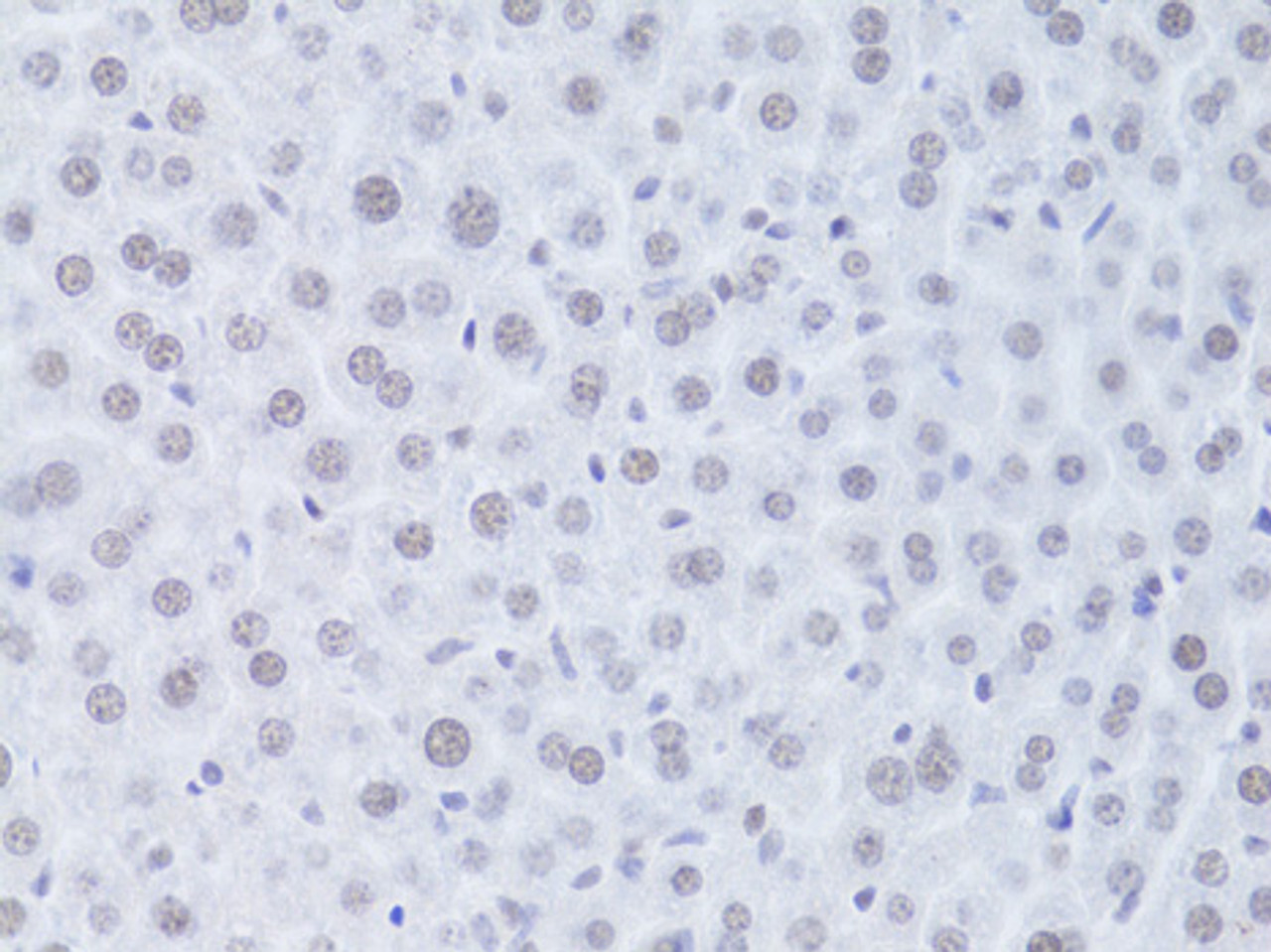 Immunohistochemistry of paraffin-embedded Mouse liver using CDKN1A Polyclonal Antibody at dilution of  1:100 (40x lens).