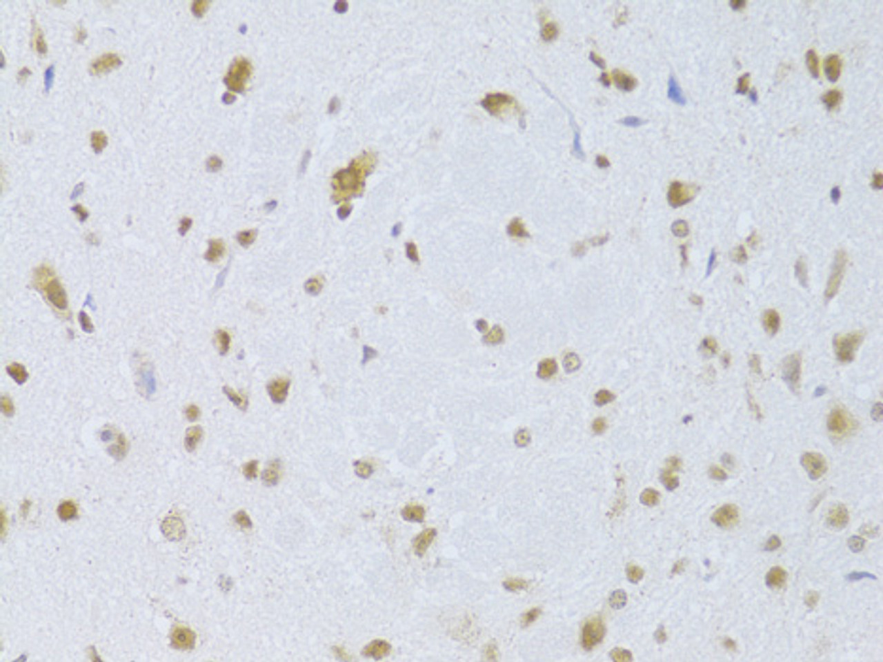 Immunohistochemistry of paraffin-embedded Mouse brain using CDKN1A Polyclonal Antibody at dilution of  1:100 (40x lens).