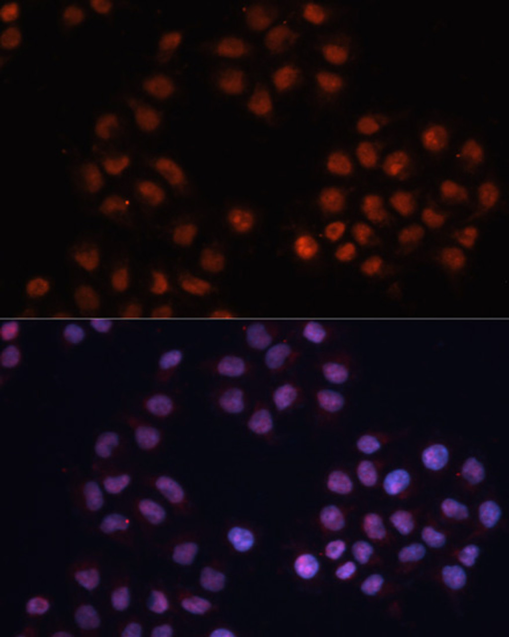 Immunofluorescence analysis of HeLa cells using CDKN1A Polyclonal Antibody at dilution of  1:100. Blue: DAPI for nuclear staining.