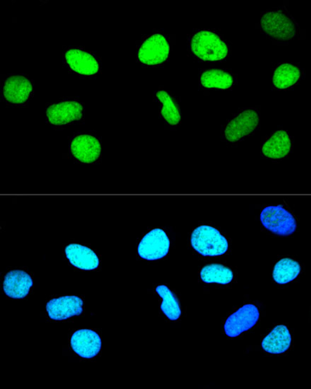 Confocal immunofluorescence analysis of U-2 OS cells using Histone H2AX Polyclonal Antibody at dilution of  1:400. Blue: DAPI for nuclear staining.