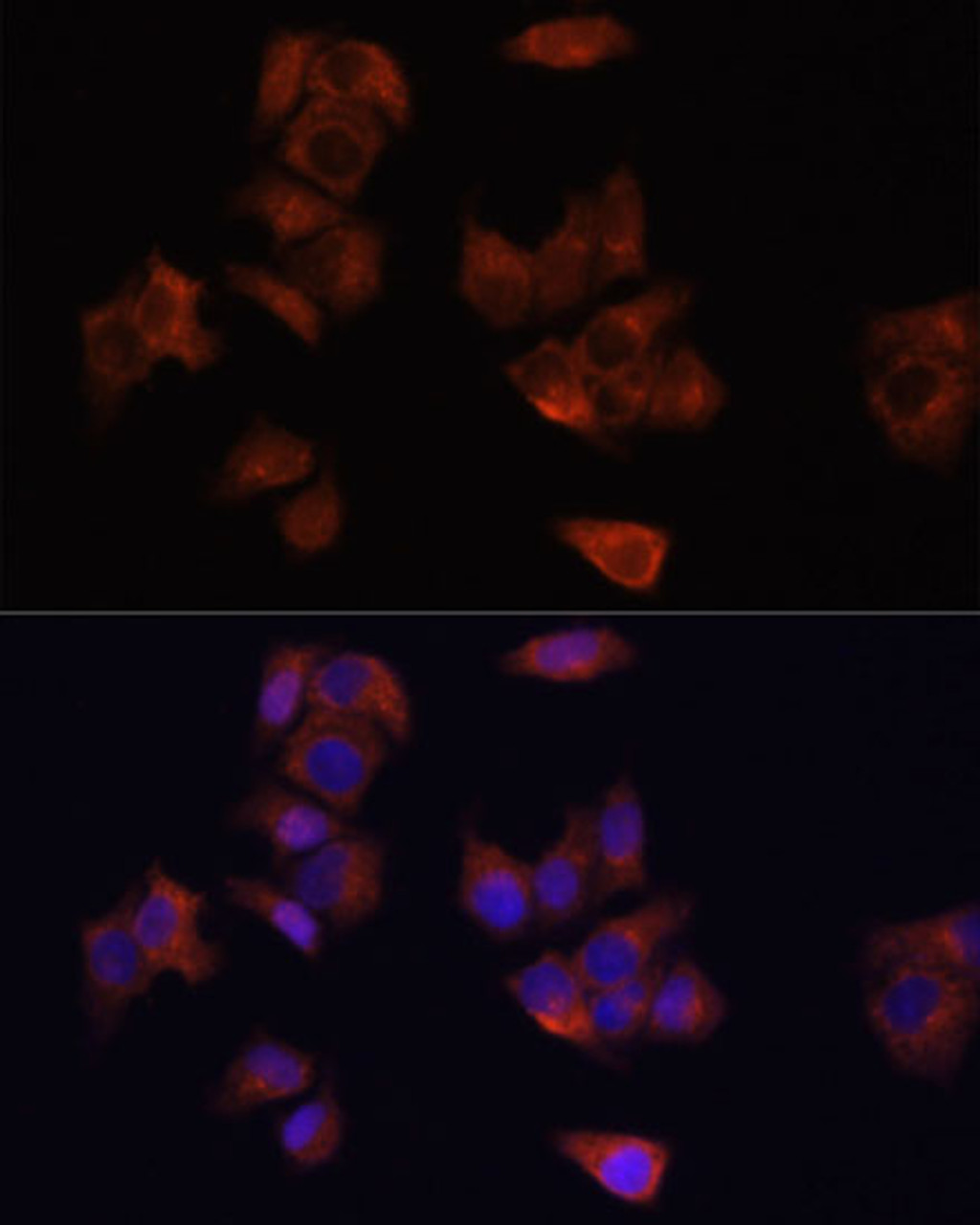 Immunofluorescence analysis of HeLa cells using LAMP1 Polyclonal Antibody at dilution of  1:100. Blue: DAPI for nuclear staining.