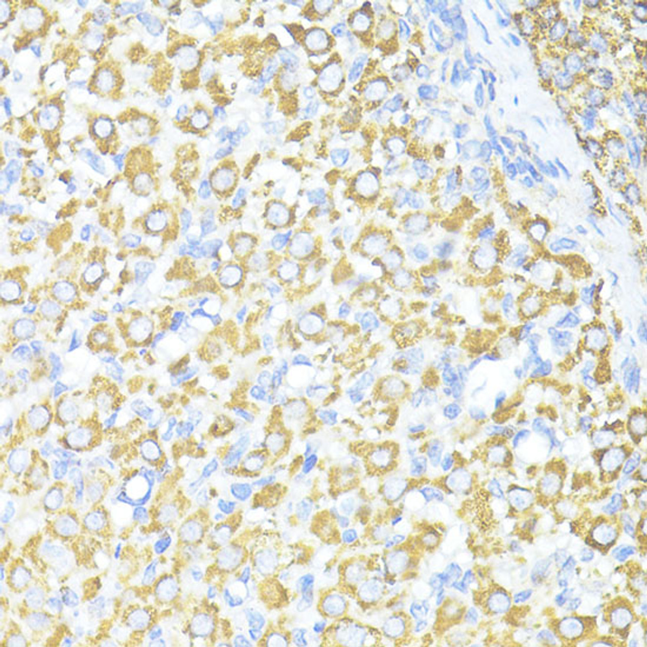 Immunohistochemistry of paraffin-embedded Rat ovary using SQSTM1 / p62 Polyclonal Antibody at dilution of  1:100 (40x lens).