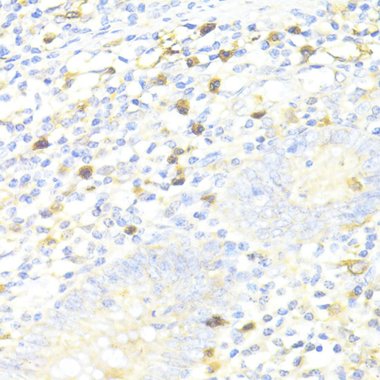 Immunohistochemistry of paraffin-embedded Human appendix using SQSTM1 / p62 Polyclonal Antibody at dilution of  1:100 (40x lens).