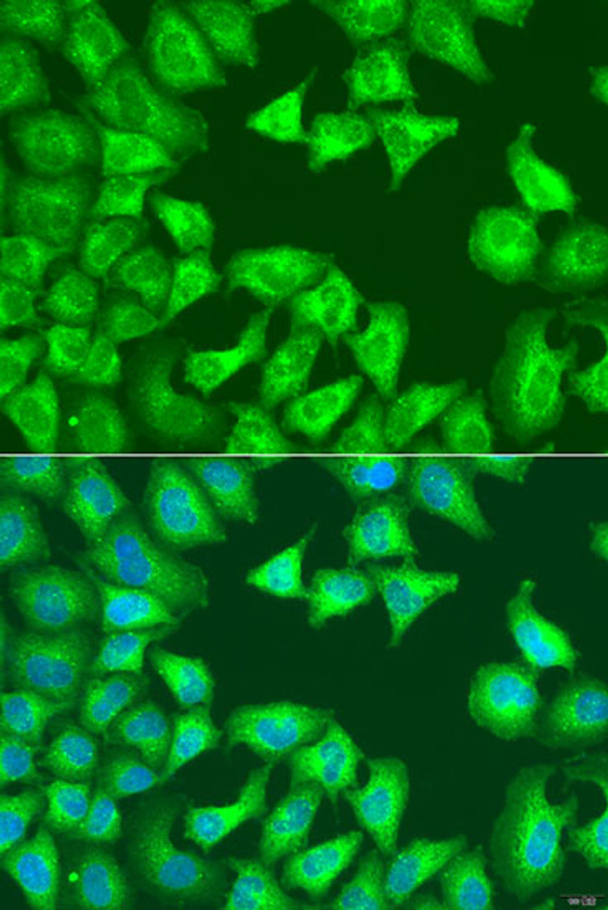 Immunofluorescence analysis of U2OS cells using SQSTM1 / p62 Polyclonal Antibody at dilution of  1:100. Blue: DAPI for nuclear staining.