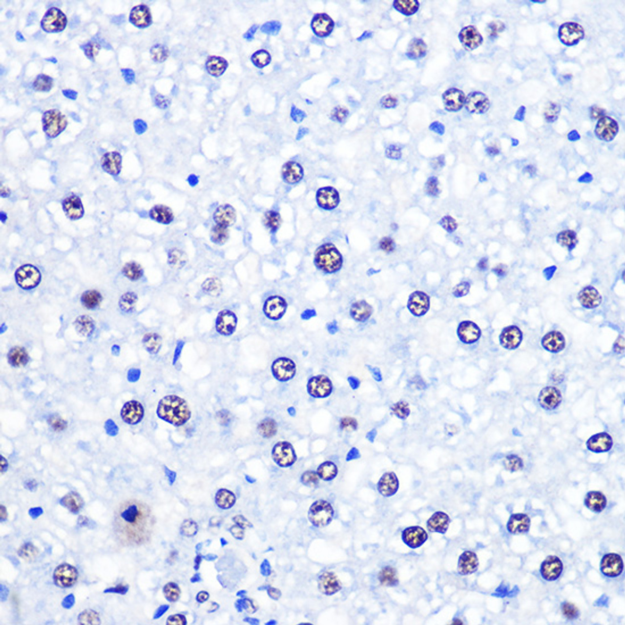 Immunohistochemistry of paraffin-embedded Rat liver using CHD4 Polyclonal Antibody at dilution of  1:100 (40x lens).