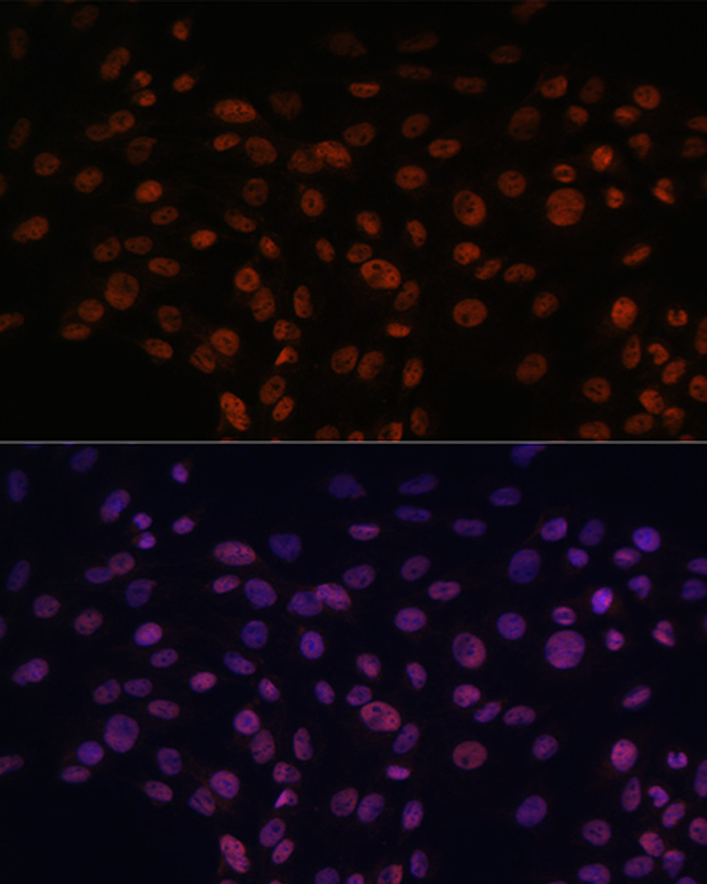 Immunofluorescence analysis of C6 cells using CHD4 Polyclonal Antibody at dilution of  1:100. Blue: DAPI for nuclear staining.