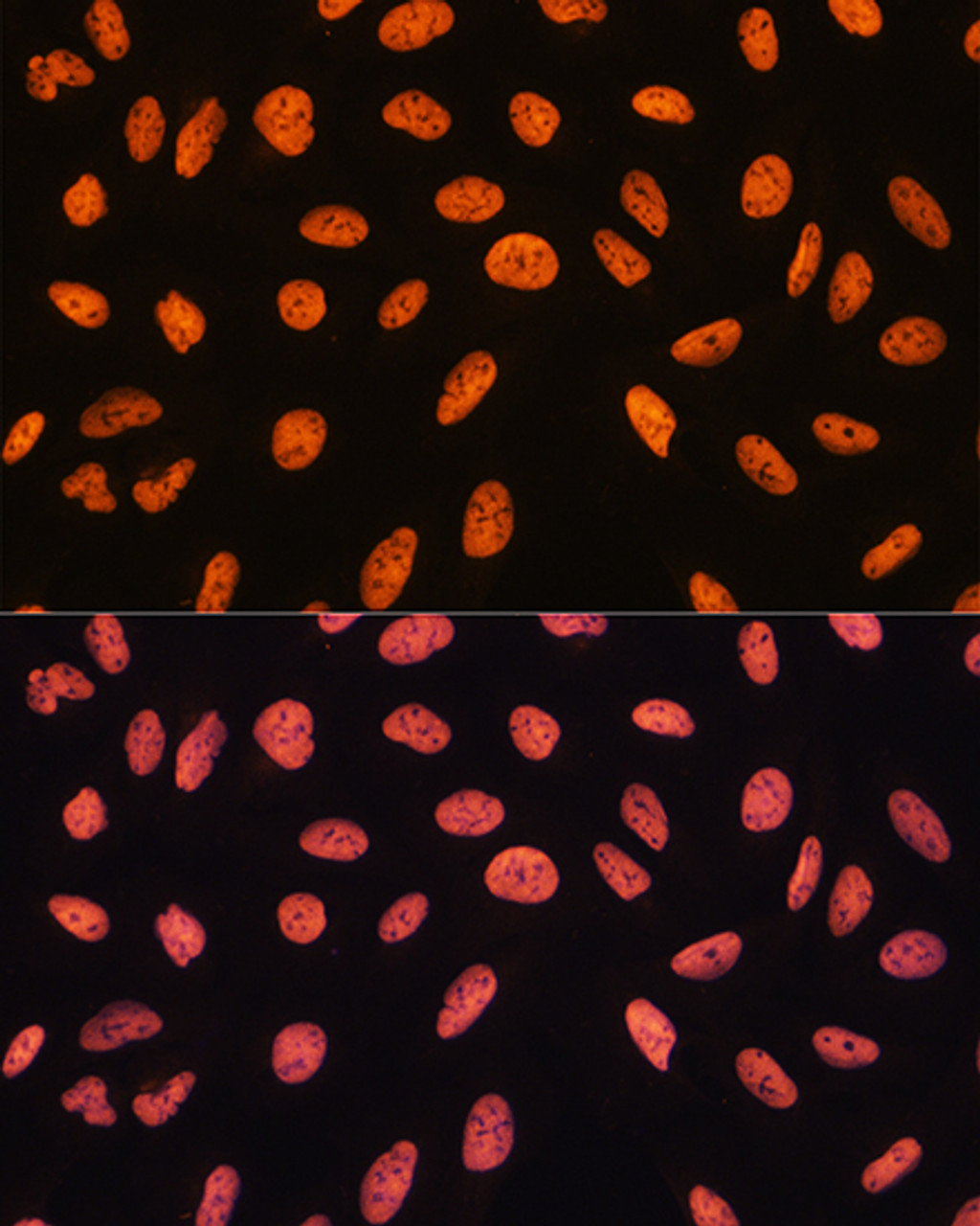 Immunofluorescence analysis of U20S cells using CHD4 Polyclonal Antibody at dilution of  1:100. Blue: DAPI for nuclear staining.