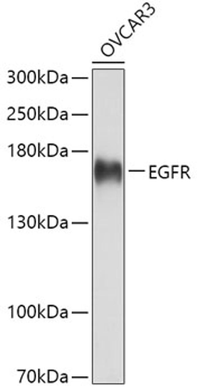 Western blot analysis of extracts of OVCAR3 cells using EGFR Polyclonal Antibody at dilution of 1:3000.