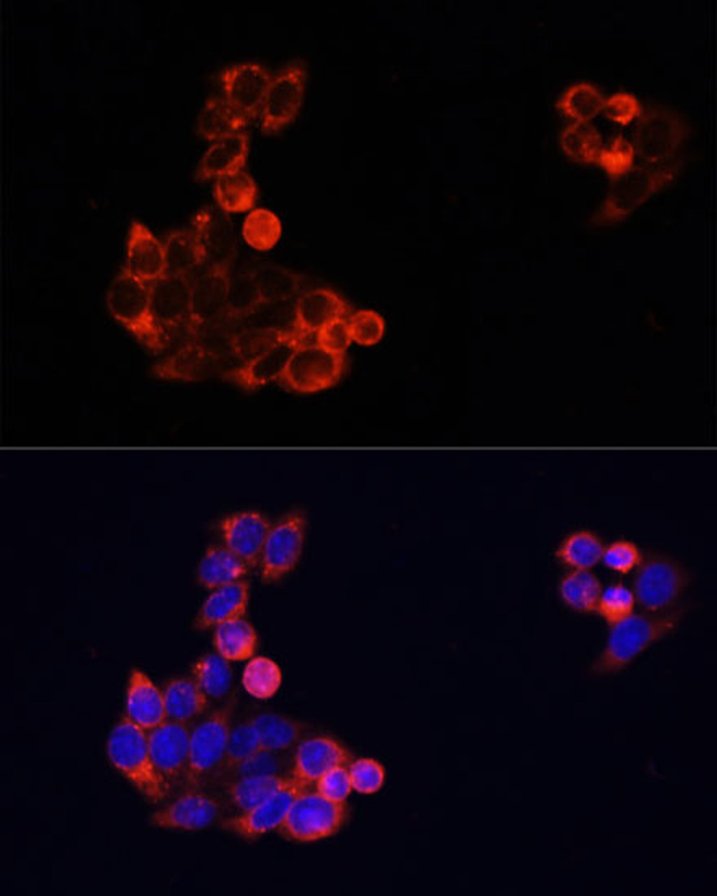 Immunofluorescence analysis of HeLa cells using EGFR Polyclonal Antibody at dilution of  1:100. Blue: DAPI for nuclear staining.