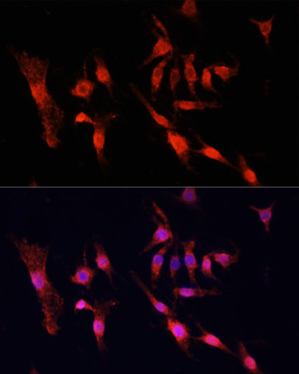 Immunofluorescence analysis of PC12 cells using EGFR Polyclonal Antibody at dilution of  1:100. Blue: DAPI for nuclear staining.